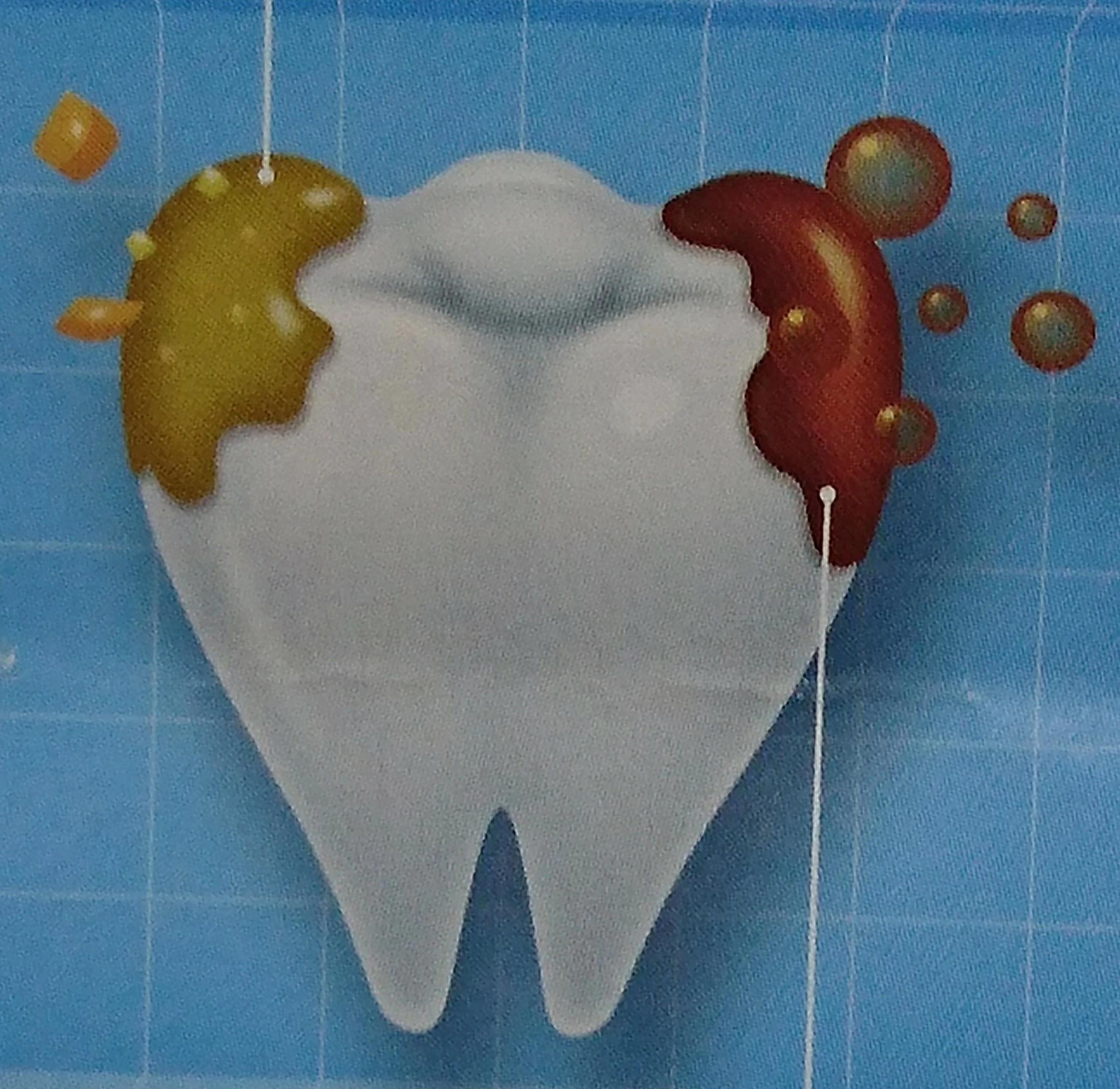 歯が溶ける