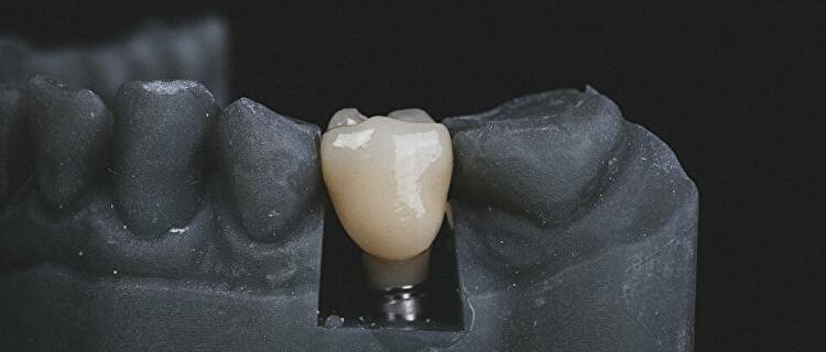 乳歯の生え方とケアのポイント